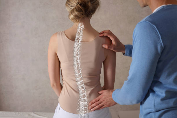 rolfing scoliosis